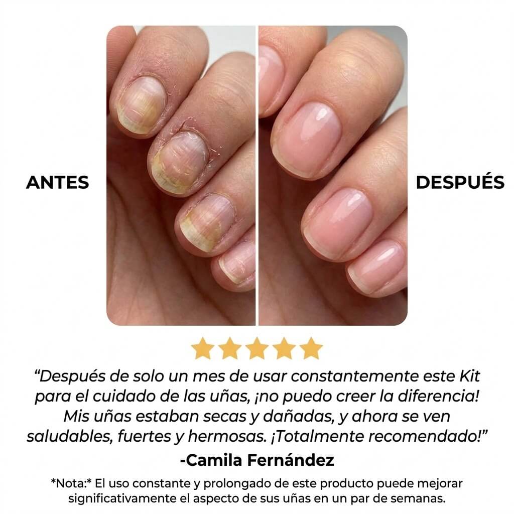 7Days Elimina Hongos - Cuida de tu uñas ya !!   ¡COMPRA 1 Y LLÉVATE OTRO GRATIS!